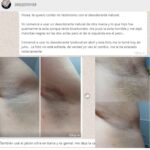 Desodorante Natural – Aclara la Piel sin Irritación