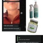 Resultados con jabón y desodorante natural BN – Antes y después